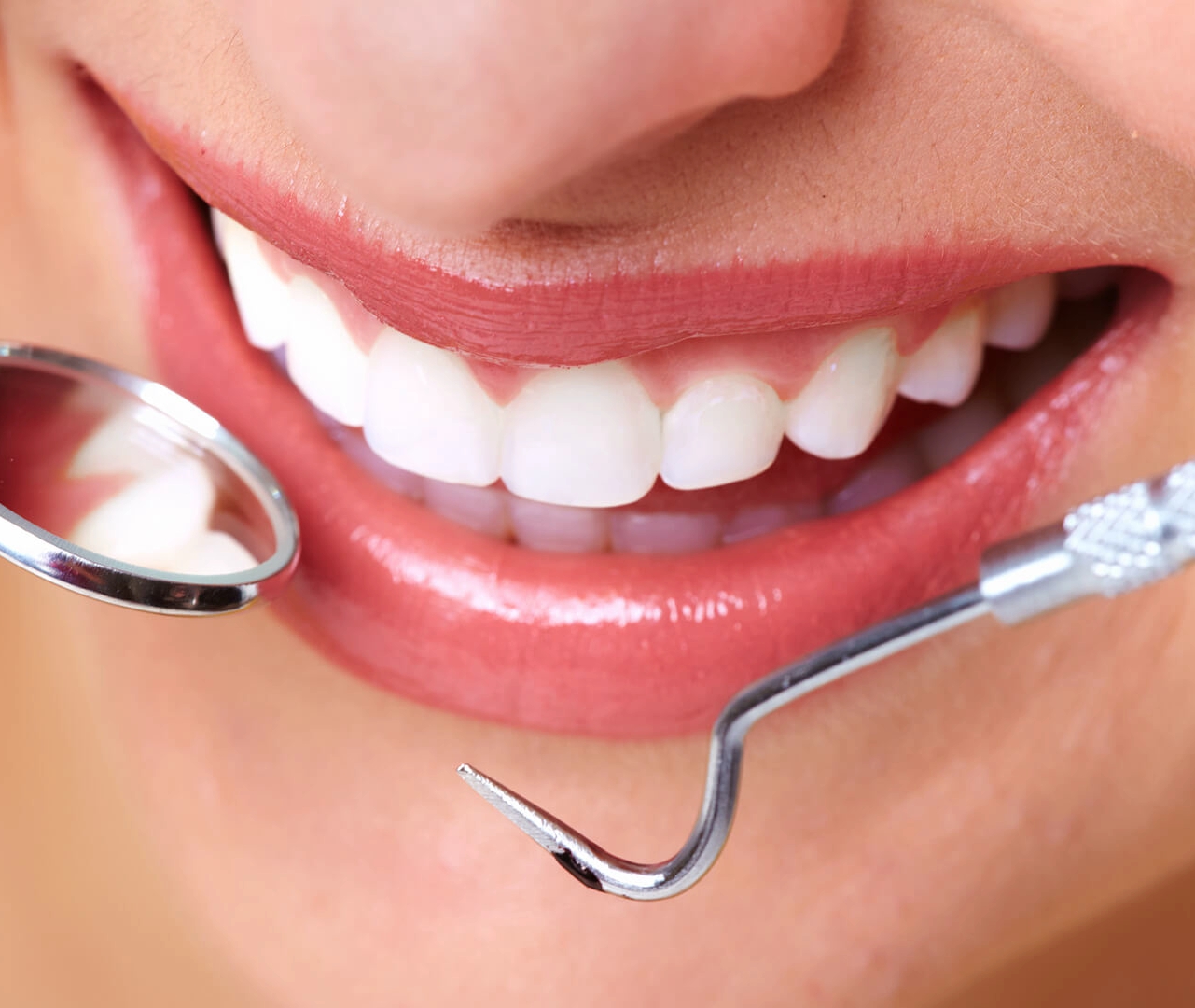Шинирование в стоматологии
